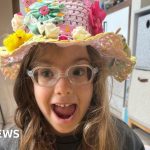 A young girl smiling in a hospital after gene therapy sight restoration.